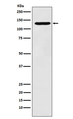 Pyruvate Carboxylase Recombinant Rabbit Monoclonal Antibody (K01_3Y63)