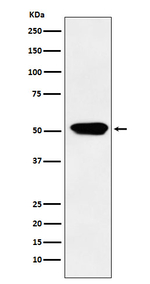 CYP4A11 Recombinant Rabbit Monoclonal Antibody (K01_3Y73)