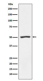 PSMD4 Recombinant Rabbit Monoclonal Antibody (K01_3Y83)