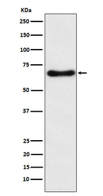CYP24A1 Recombinant Rabbit Monoclonal Antibody (K01_3Y85)