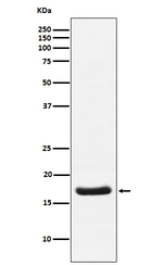 Cardiac Troponin C Recombinant Rabbit Monoclonal Antibody (K01_3Y87)