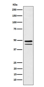 Brachyury Recombinant Rabbit Monoclonal Antibody (K01_3Y93)