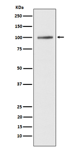 SERCA1 ATPase Recombinant Rabbit Monoclonal Antibody (K01_4J01)