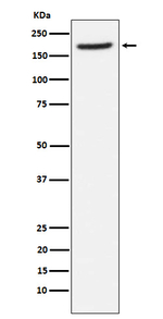 CD249 Recombinant Rabbit Monoclonal Antibody (K01_4J03)