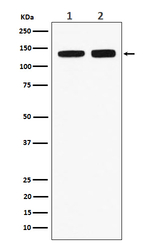 RNF40 Recombinant Rabbit Monoclonal Antibody (K01_4J04)