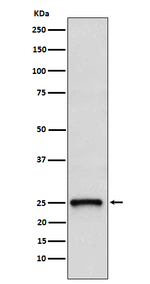 TC10 Recombinant Rabbit Monoclonal Antibody (K01_4J11)