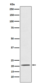 PAEP Recombinant Rabbit Monoclonal Antibody (K01_4J16)
