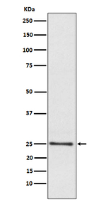 LYPLA1 Recombinant Rabbit Monoclonal Antibody (K01_4J18)
