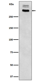 Thyroglobulin Antibody in Western Blot (WB)