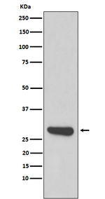 Calpain S1 Recombinant Rabbit Monoclonal Antibody (K01_4J21)