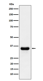 PSMD14 Recombinant Rabbit Monoclonal Antibody (K01_4J33)