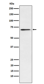 L-Plastin Recombinant Rabbit Monoclonal Antibody (K01_4J35)