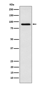 RSK4 Recombinant Rabbit Monoclonal Antibody (K01_4J37)