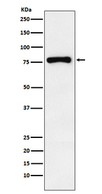 RNaseL Recombinant Rabbit Monoclonal Antibody (K01_4J52)