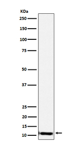 SPINK1 Recombinant Rabbit Monoclonal Antibody (K01_4J57)