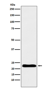 Troponin I Antibody in Western Blot (WB)
