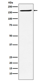 SMC4 Recombinant Rabbit Monoclonal Antibody (K01_4J59)