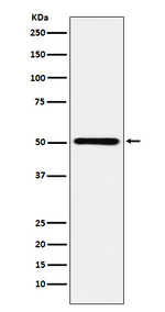 RING1 Recombinant Rabbit Monoclonal Antibody (K01_4J61)