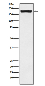 MRC2 Recombinant Rabbit Monoclonal Antibody (K01_4J65)