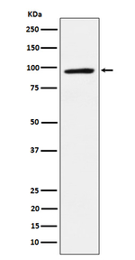 TAB3 Recombinant Rabbit Monoclonal Antibody (K01_4J80)