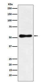 RORB Recombinant Rabbit Monoclonal Antibody (K01_4J83)