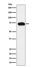 SLC22A1 Recombinant Rabbit Monoclonal Antibody (K01_4J91)