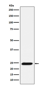 Bmf Recombinant Rabbit Monoclonal Antibody (K01_4J96)