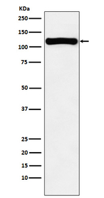 VPS11 Antibody in Western Blot (WB)