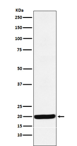RBM8A Recombinant Rabbit Monoclonal Antibody (K01_4J98)