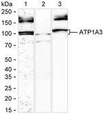 ATP1A3 Recombinant Rabbit Monoclonal Antibody (K01_4K07)