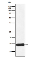 CRABP1 Recombinant Rabbit Monoclonal Antibody (K01_4K10)