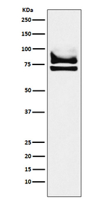DDX17 Recombinant Rabbit Monoclonal Antibody (K01_4K19)