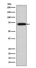 TRIM29 Recombinant Rabbit Monoclonal Antibody (K01_4K43)