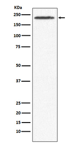 SMCHD1 Recombinant Rabbit Monoclonal Antibody (K01_4K53)