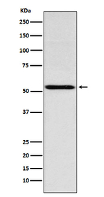 THRA Antibody in Western Blot (WB)