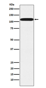 PUM2 Recombinant Rabbit Monoclonal Antibody (K01_4K60)