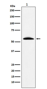 GGT1 Recombinant Rabbit Monoclonal Antibody (K01_4K80)