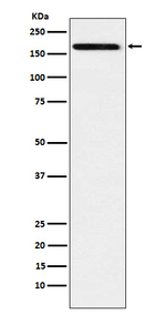 IL17RA Recombinant Rabbit Monoclonal Antibody (K01_4K83)