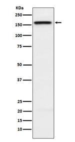 KIF4A Recombinant Rabbit Monoclonal Antibody (K01_4K87)