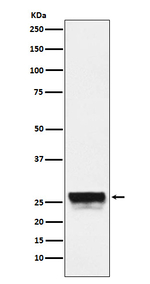 CTRL Antibody in Western Blot (WB)