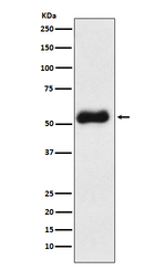Thromboxane synthase Recombinant Rabbit Monoclonal Antibody (K01_4K93)