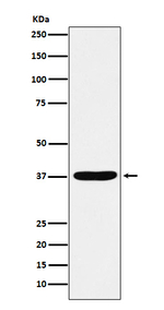 AKR1C1/AKR1C2 Recombinant Rabbit Monoclonal Antibody (K01_4K95)