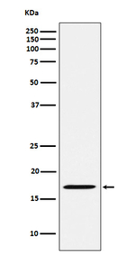 FHIT Recombinant Rabbit Monoclonal Antibody (K01_4K96)