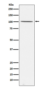 Gemin 3 Recombinant Rabbit Monoclonal Antibody (K01_4K97)