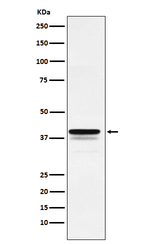 FOXF1 Recombinant Rabbit Monoclonal Antibody (K01_4K98)