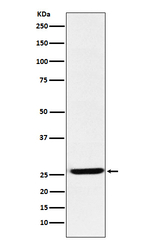 EBI3 Recombinant Rabbit Monoclonal Antibody (K01_4L04)