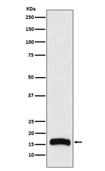 FLAP Recombinant Rabbit Monoclonal Antibody (K01_4L08)