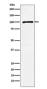 GluR6 Recombinant Rabbit Monoclonal Antibody (K01_4L09)