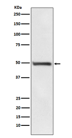 RAD52 Recombinant Rabbit Monoclonal Antibody (K01_4L12)