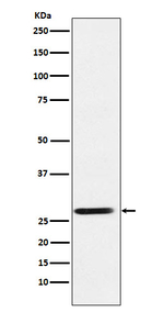 SRD5A2 Recombinant Rabbit Monoclonal Antibody (K01_4L14)